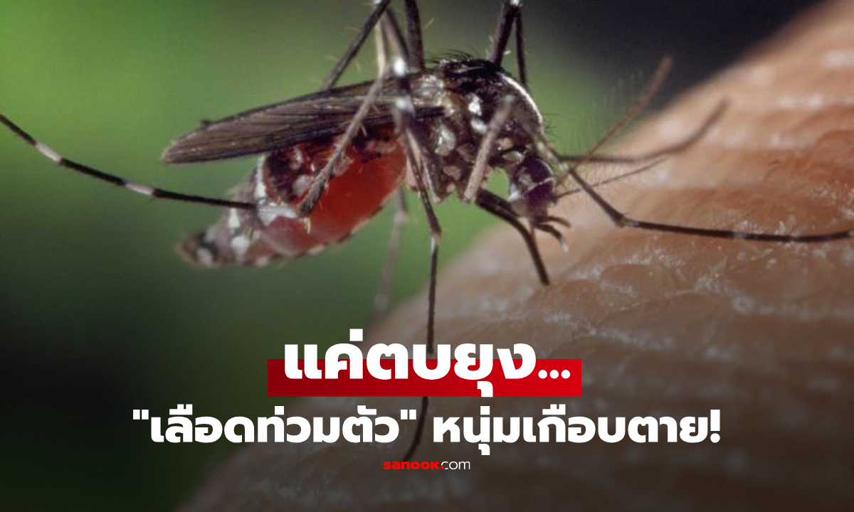 แค่ตบยุงที่มากัด! หนุ่มช็อก “เลือดตัวเอง” ทะลักท่วมอก หมอชี้จุดพลาดวิกฤตถึงชีวิต