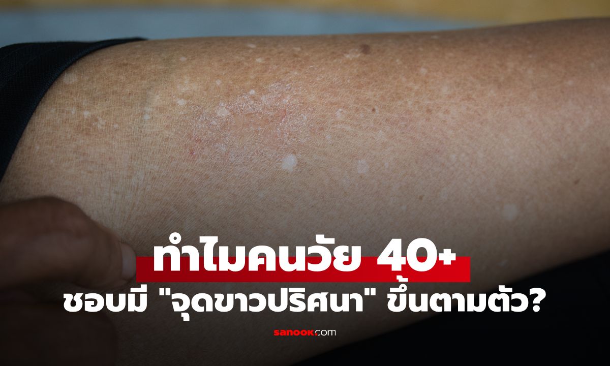 ทำไมคนวัย 40+ ชอบมี "จุดขาวปริศนา" ขึ้นตามตัว? หมอผิวหนังเปิดสาเหตุแท้จริง