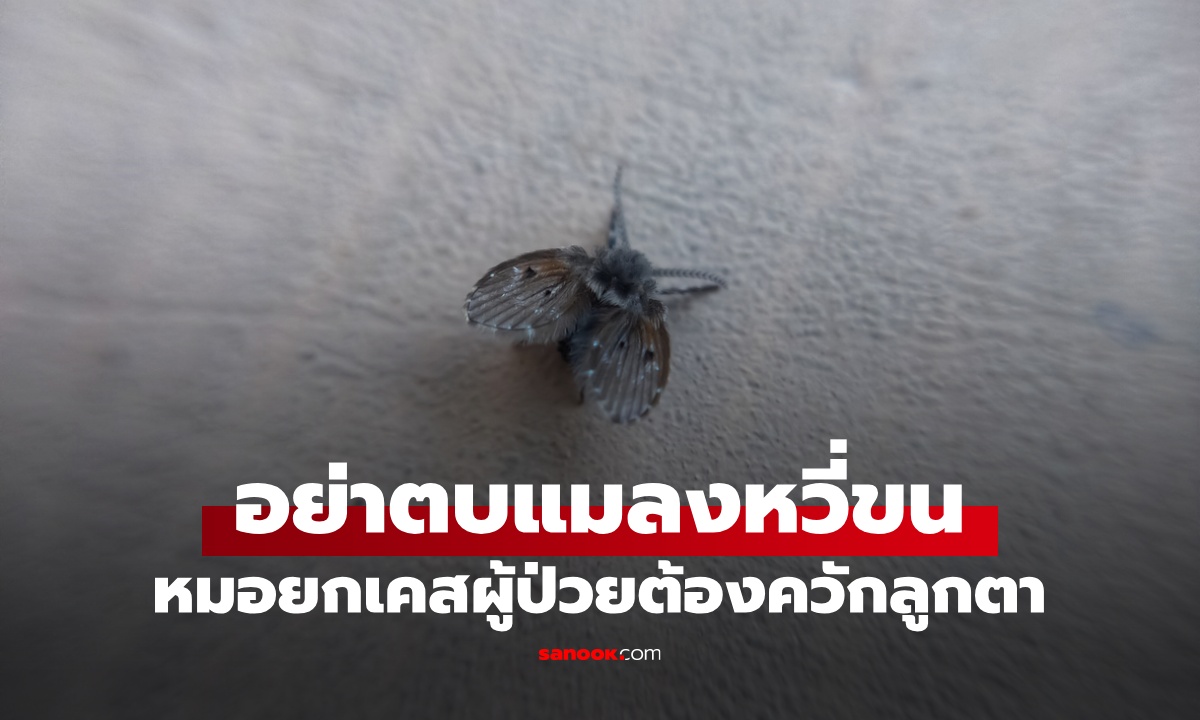 อย่าตบ "แมลงหวี่ขน" ซ่อนอันตรายที่คาดไม่ถึง หมอยกเคสเตือนผู้ป่วยต้องควักลูกตา!