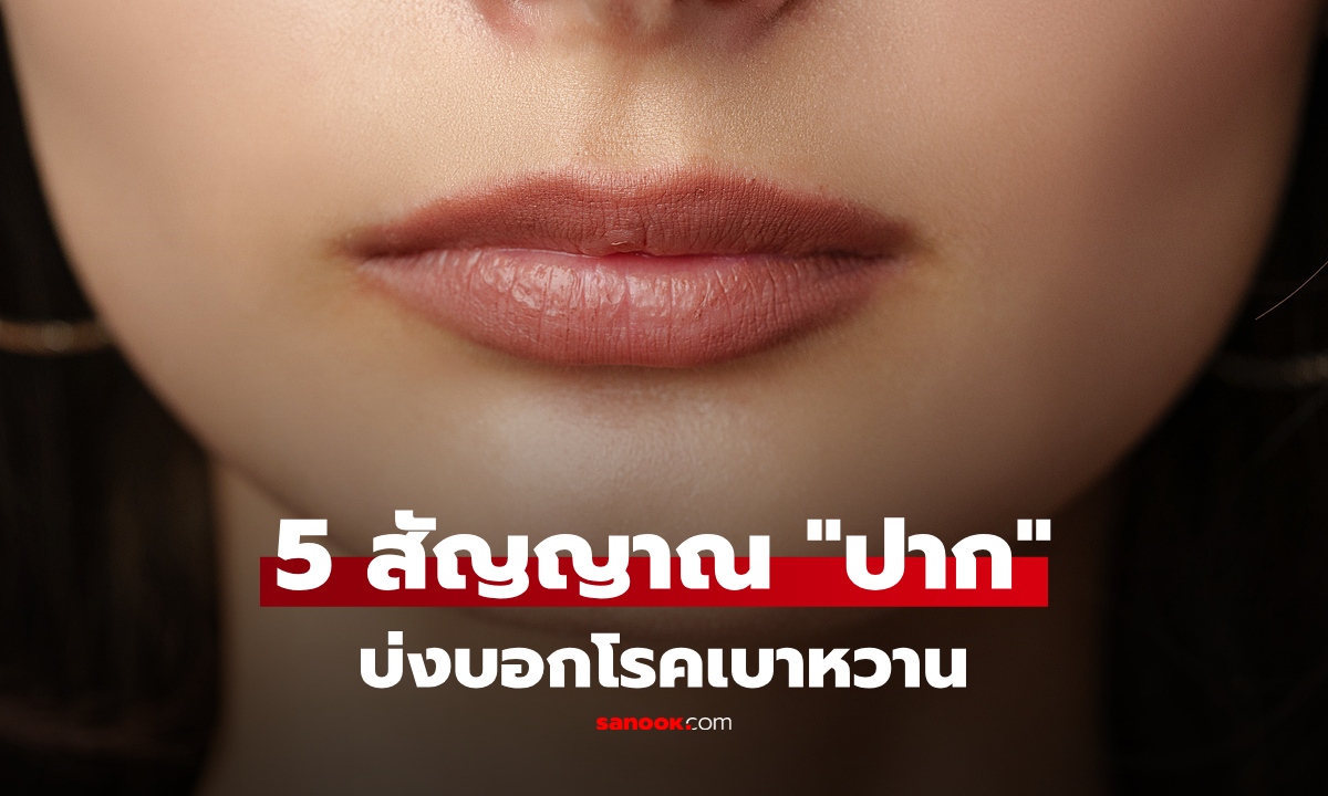 เปิด 5 สัญญาณ ชี้เสี่ยง "เบาหวาน" เช็กได้ที่ "ปาก" ข้อ 1 พบในผู้ป่วยถึง 49%
