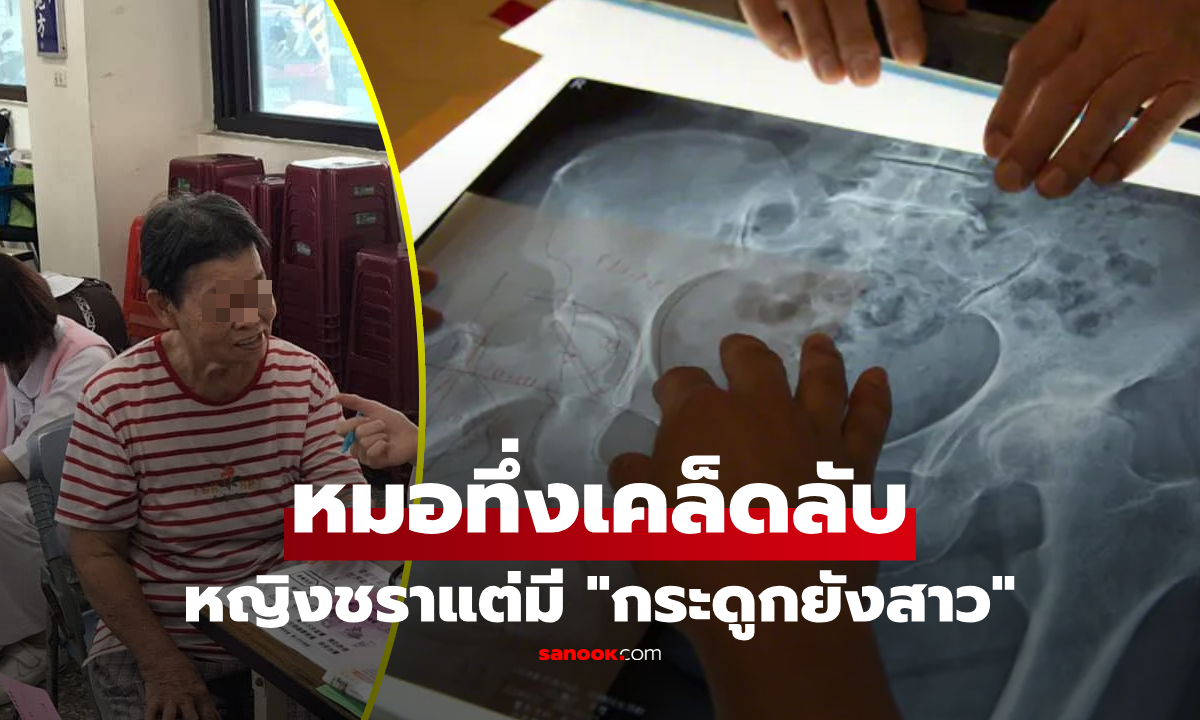 หมอทึ่ง! หญิงวัยชราแต่มี \