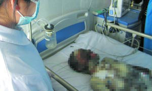 กตัญญู ลูกวัย 13 ปี เสี่ยงชีวิตช่วยแม่ ในเหตุการณ์ไฟไหม้