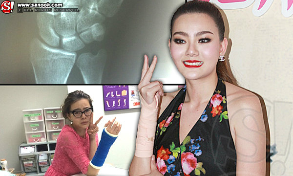 หวานซะ!! "ดิว อริสรา" ให้ใจ "ไผ่ วันพ้อยด์" หลังช่วยดูแลกระดูกข้อมือร้าว