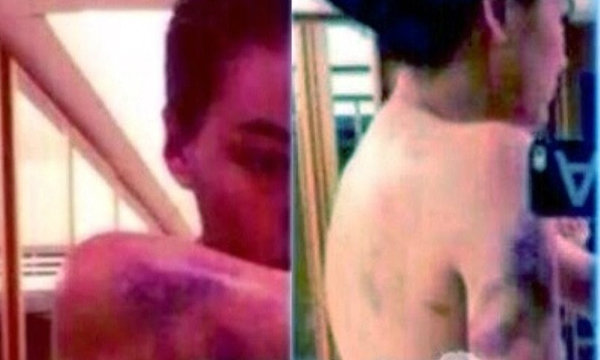 หลุดว่อน! ภาพคล้ายนางเอกสาวถูกซ้อม ช้ำทั้งตัว