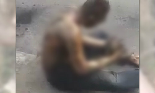 สุดโหด! ราดน้ำมันจุดไฟเผาหนุ่มทั้งเป็น ตร.เร่งล่าตัว