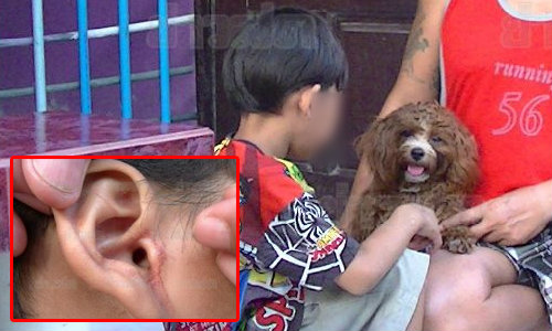 ดช.6 ขวบบ่นคันหู ส่องดูเจอเห็บสุนัขอื้อ
