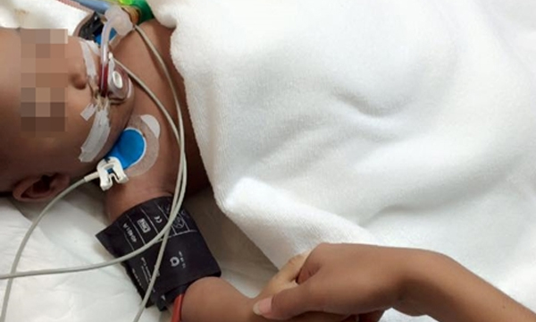 อุทาหรณ์พ่อแม่! เด็กวิ่งเล่นล้มหัวโน  2 วันถัดมาเสียชีวิต