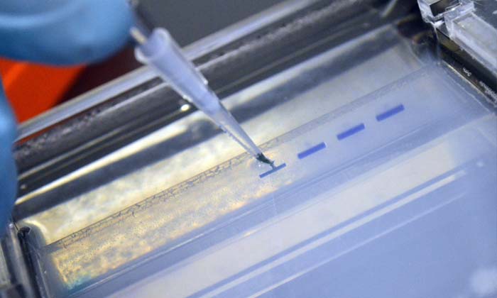 ตะลึง เด็กแฝดชาวเวียดนาม ตรวจดีเอ็นเอพบมีพ่อคนละคน