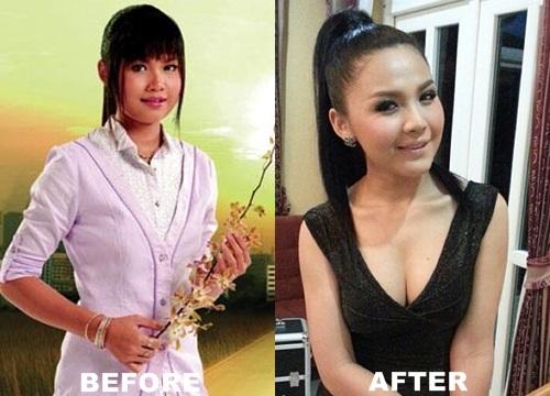 ตั๊กแตน ชลดา