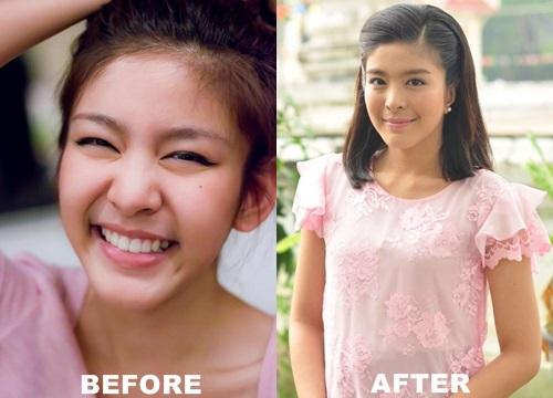 คลิกชมภาพต่อไป คลิกชมภาพต่อไป