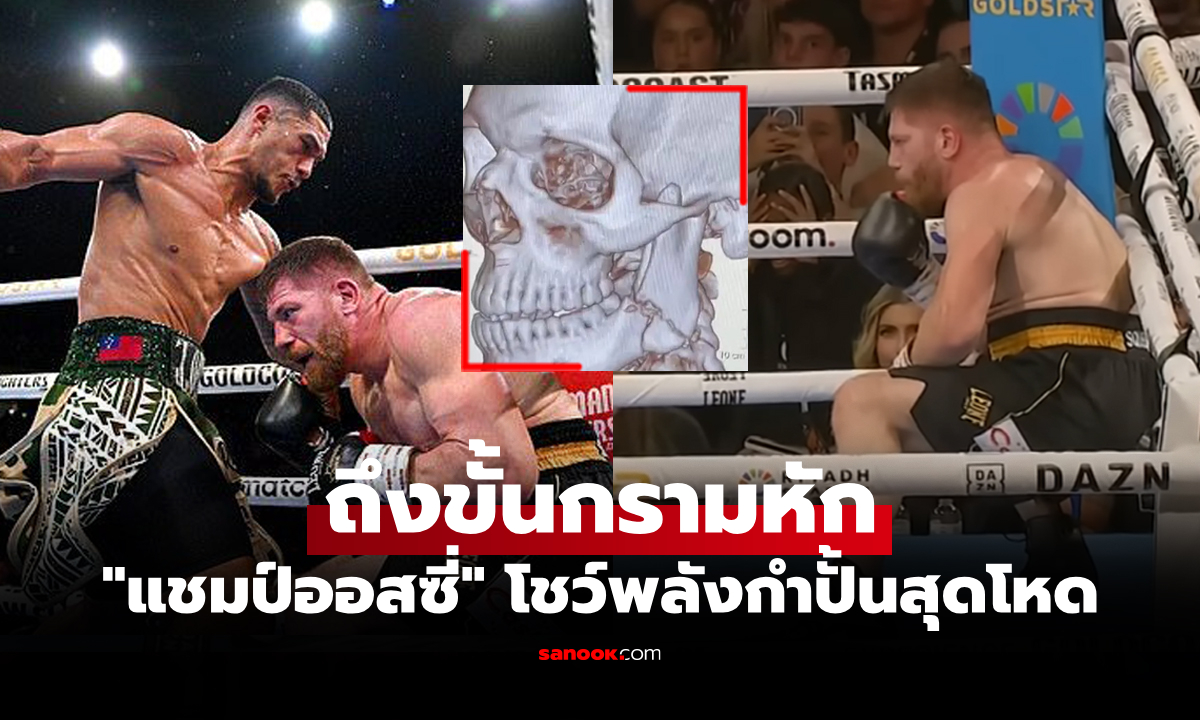 สุดช็อก! \
