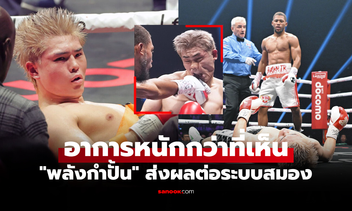 แบบนี้ก็มีด้วย! \