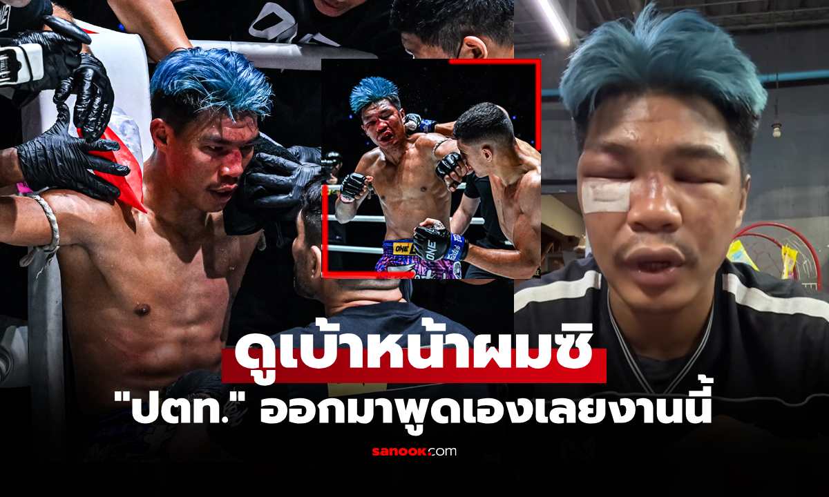เอายังไงต่อจากนี้! \